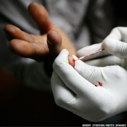 Hiv testing